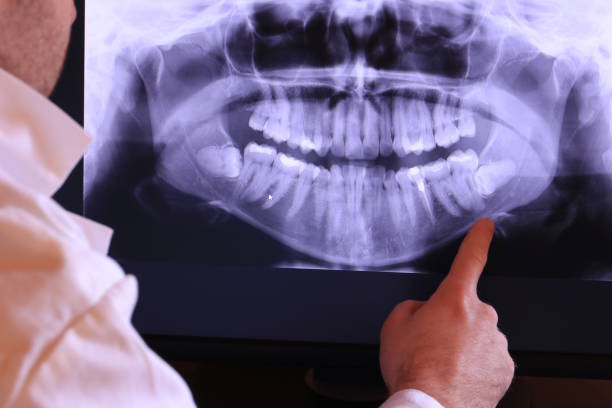 Best Emergency Gum Pain Relief  in Olathe, KS