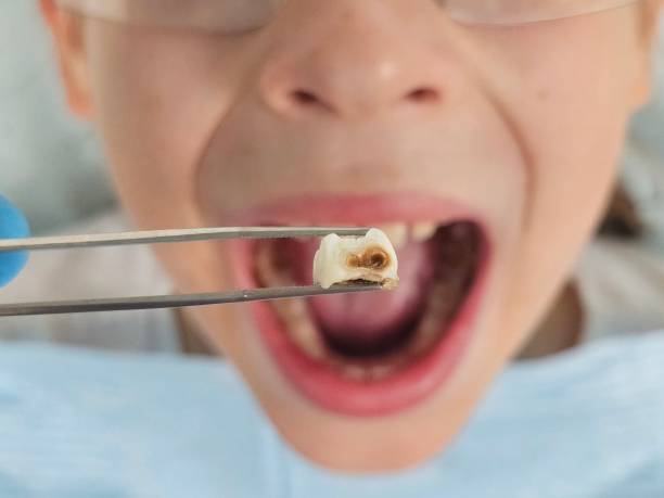 Best Broken Tooth Emergency  in Olathe, KS