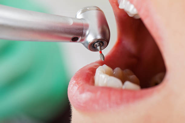 Best Knocked-Out Tooth Emergency  in Olathe, KS